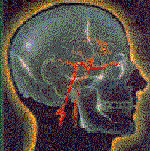 poisoned mind